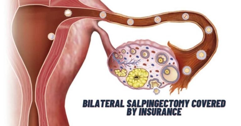 Bilateral Salpingectomy Covered By Insurance
