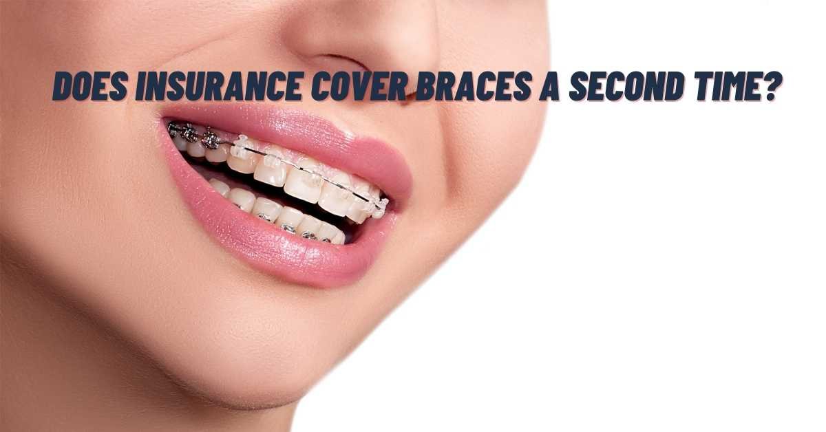 Does Insurance Cover Braces A Second Time