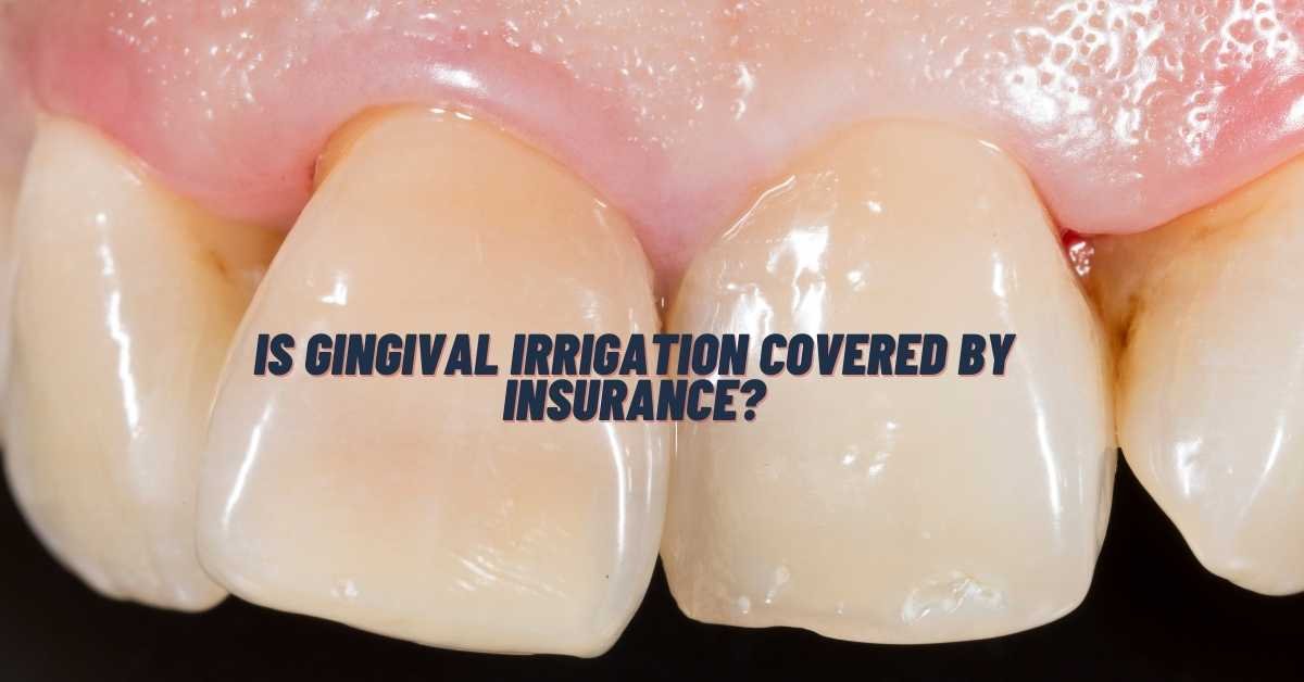 Is Gingival Irrigation Covered By Insurance